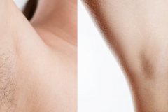 Woman with armpit hair, female hairy armpit, clean woman armpit, before and after shaving