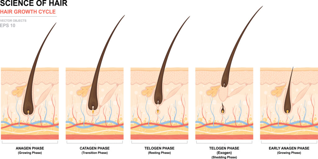 Laser Hair Removal – Body Phaze